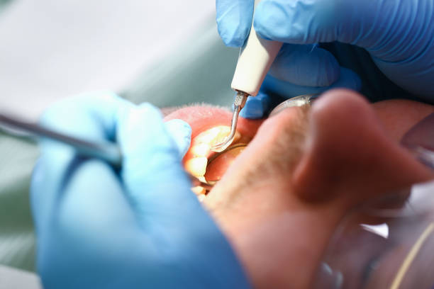 Best Emergency Broken Tooth Repair in Fort Stockton, TX