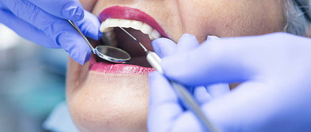 Best Emergency Broken Tooth Repair in Fort Stockton, TX